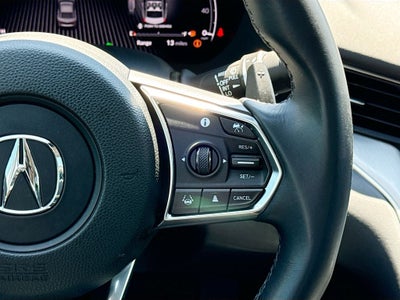 2025 Acura TLX Technology Package